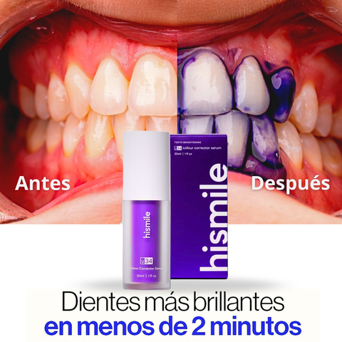 Blanqueador Dental – ¡Dientes más blancos